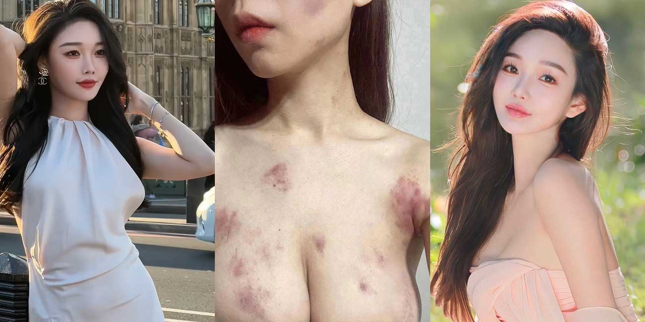 【51吃瓜网首发】抖音百万粉丝博主 雅典娜Liya 被闺蜜骗去菲律宾卖进妓院！惨遭毒打、强奸 奶子都被打得青一片紫一片